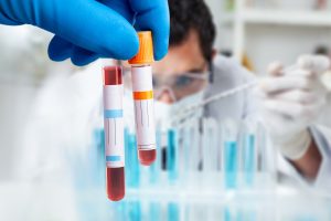 Doctor holding blood sample in test tube