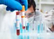 Doctor holding blood sample in test tube