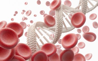 How to Treat Hereditary Hemochromatosis in Your Chronic Patients