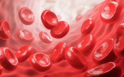 How to Root Out Iron-Overload Anemias in Your Patients