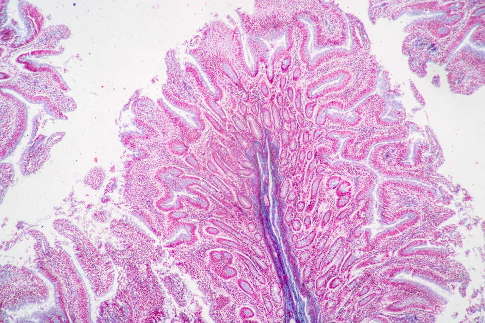 Treating a Pathology vs. Managing Systemic Dysfunction: What’s the Difference?