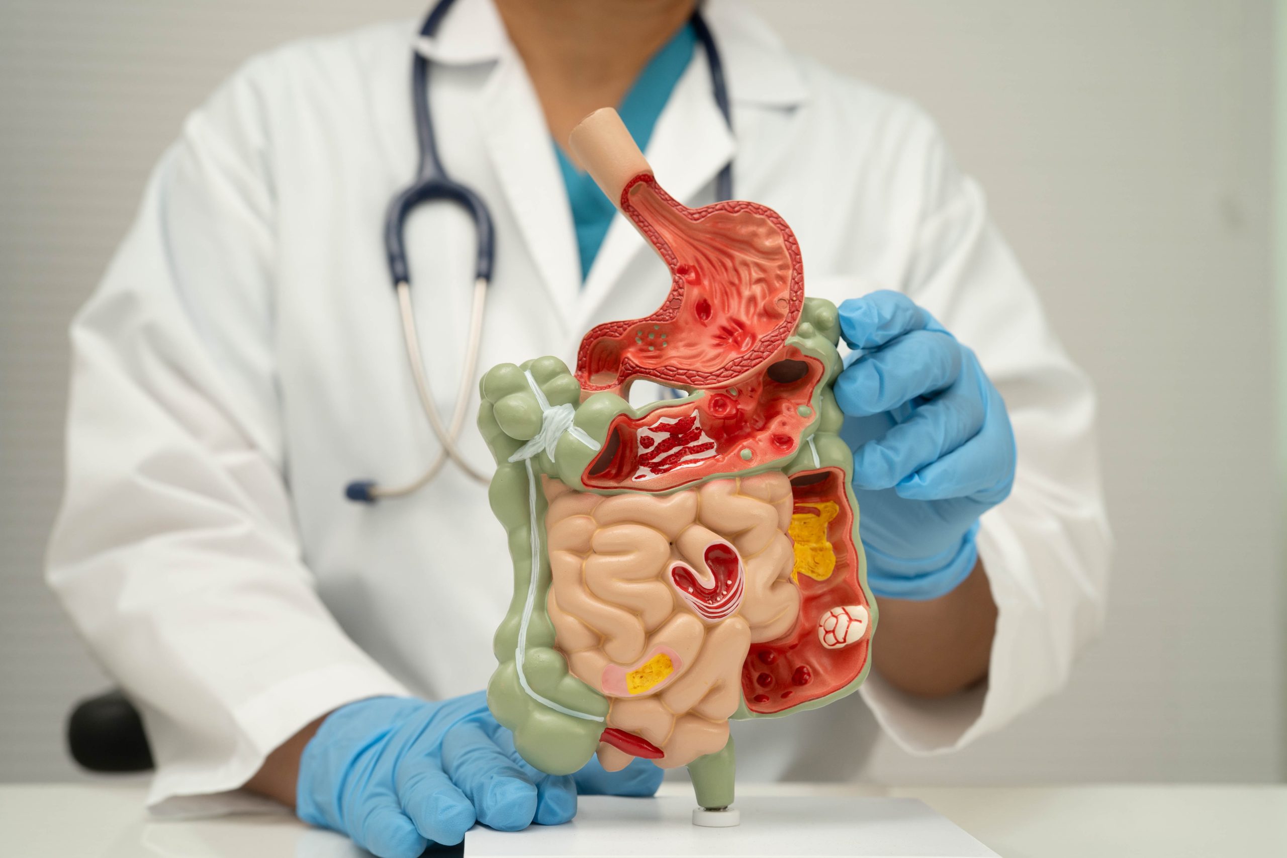 Model of a digestive system with stomach and intestine, being held by a doctor.